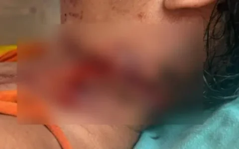 Mulher é socorrida com ferimento no pescoço e caso é investigado pela Polícia Civil em São Francisco do Guaporé