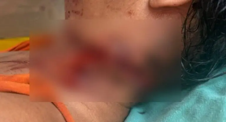 Mulher é socorrida com ferimento no pescoço e caso é investigado pela Polícia Civil em São Francisco do Guaporé