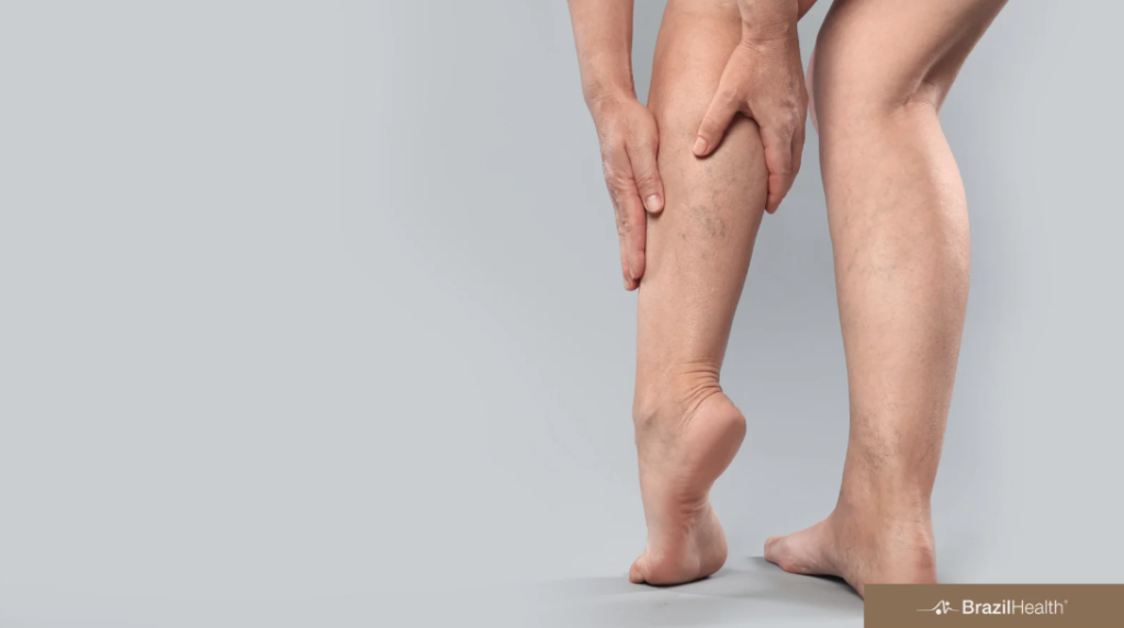 Câncer e trombose: o risco que precisa ser prevenido durante o tratamento oncológico