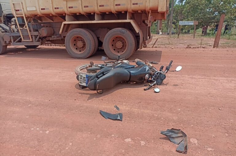 Motociclista sofre fratura na perna após colisão violenta com caminhão em Rolim de Moura